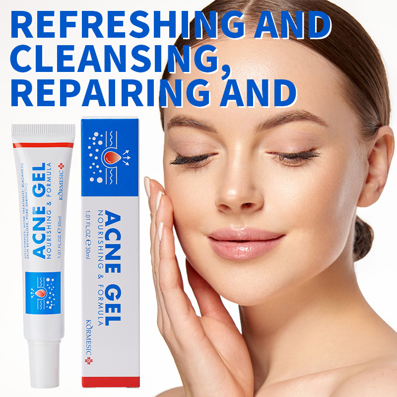 Face Moisturizer - Gel para remover acne, 30g, creme