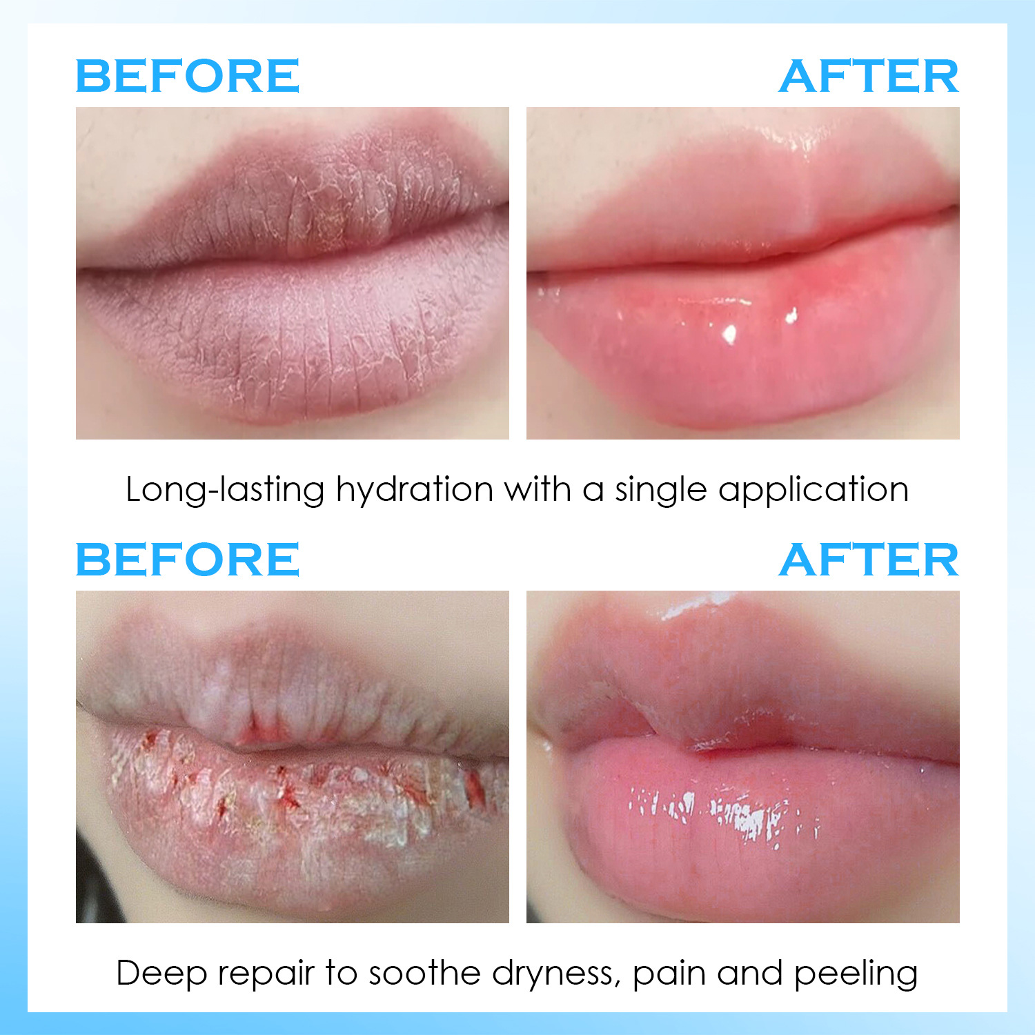 Sérum labial hidratante, bálsa - Lip Balm avaliação e preço