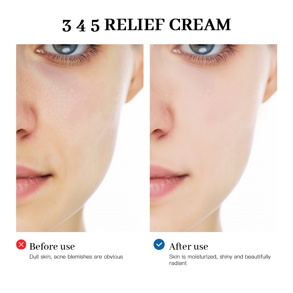 345 Creme de alívio Solução ab - Retinol Cream avaliação e preço
