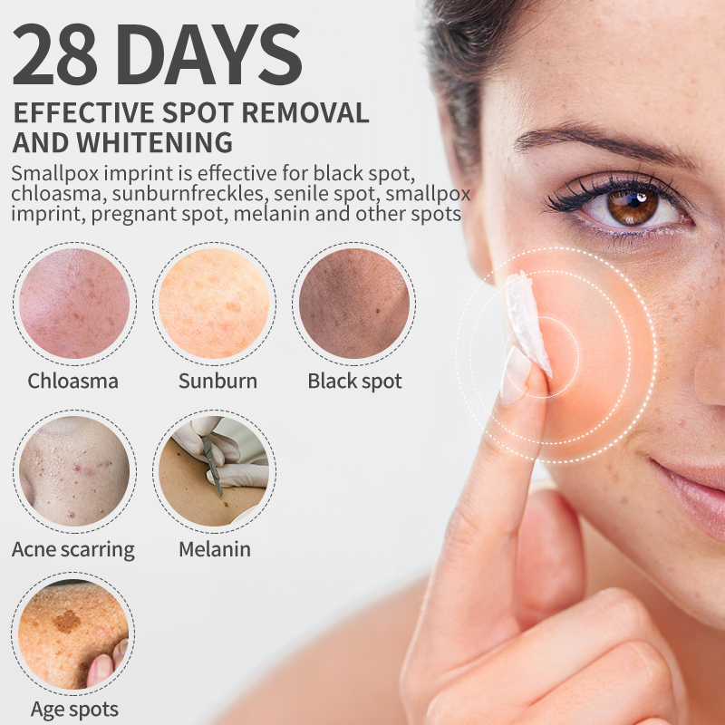 Dimollaure Whitening Freckle C - Retinol Cream avaliação e preço