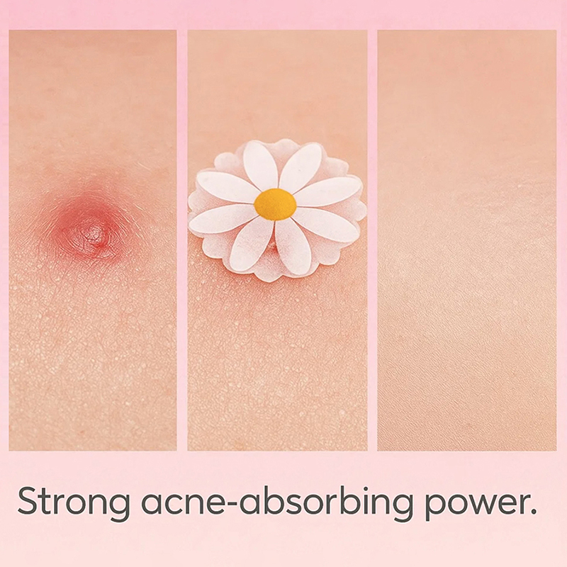 100 unidades de adesivos invis - Skincare China avaliação e preço
